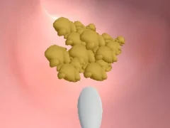 بازی Earwax Clinic آنلاین