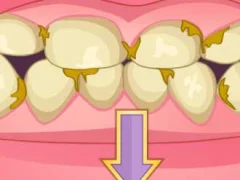 بازی Bad Teeth Makeover آنلاین