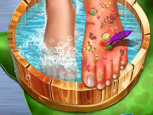 بازی Feet Skin Doctor آنلاین