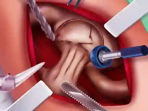 بازی Princess Hips Surgery آنلاین