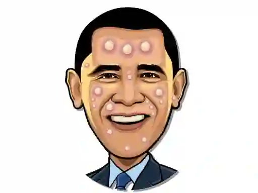بازی Celebrity Pimple Pop آنلاین